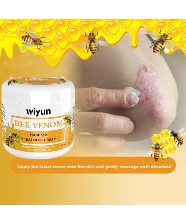 Cvreoz Bee Venom Psoriasis Cream | New Zealand Bee Venom Treatment for Psoriasis (1PC) - Fast International Shipping - Buy Online on GoSupps.com