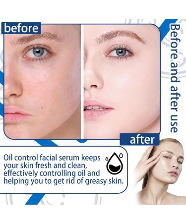 Moisturizing B5 Face Serum Mask | Lightweight Oil Control & Hydrating Facial Serum | Salicylic Acid Skin Care - Buy Online on GoSupps.com