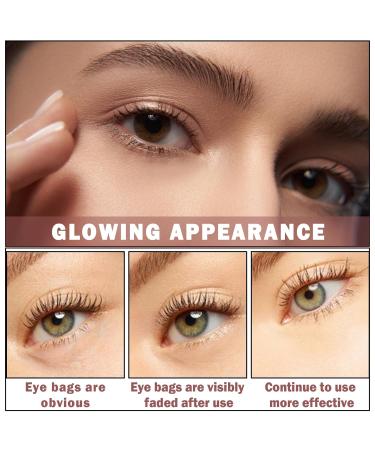 NVLEPTAP Eye Cream for Dark Circles Puffiness & Wrinkles - Reduce Bags & Fine Lines Firm & Lift Under-Eye Skin - Buy Online on GoSupps.com