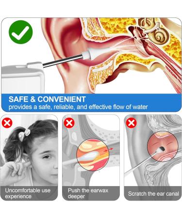 Ear Wax Removal Tool - Water Powered Ear Cleaner with 4 Reusable Tips | Electric Ear Cleaning Kit - Type-C Charging & Portable (White - Buy Online on GoSupps.com