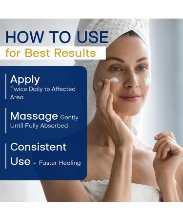 Arnica Bruise Cream Extra Strength Fast-Acting Arnica Montana with Vitamins K C & E for Bruising Swelling Discoloration & Thin Skin Hydrating Moisturizer for Face & Body 4 oz 4 Ounce (Pack of 1) - Buy Online on GoSupps.com