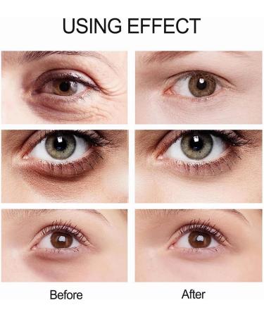 Anti Wrinkle Eye Cream Electric Under Eye Cream for Dark Circles Puffy Eyes Hydrating and Firming Eye Serum Creams Organic Eye Repair Cream Anti-Aging Eye Care Products for All Skin Types- 20g - Buy Online on GoSupps.com
