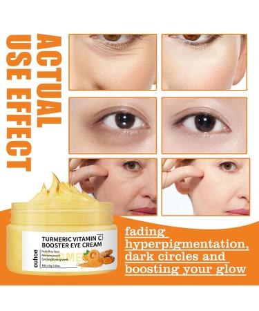 Turmeric + Vitamin C Eye Cream - Dark Circle Remover & Anti-Aging Brightening Treatment for Eyes | 30g - Buy Online on GoSupps.com
