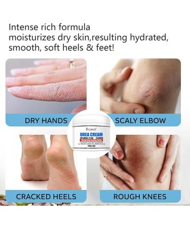 Urea Foot Cream 40% Urea Cream for Cracked Heels Callus Remover For Dry And Hard Skin Deep Moisturizing Cracked Heel Cream for Feet Knees Hand - Buy Online on GoSupps.com