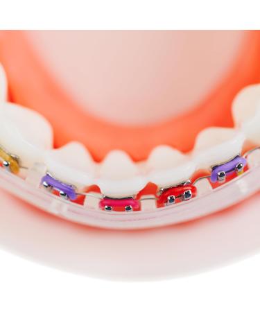 Buy DeltaDent Mouthguard for Braces - Replace Orthodontic Wax & Enhance Comfort with Lip Pads - Best Solution for Orthodontics - Buy Online on GoSupps.com