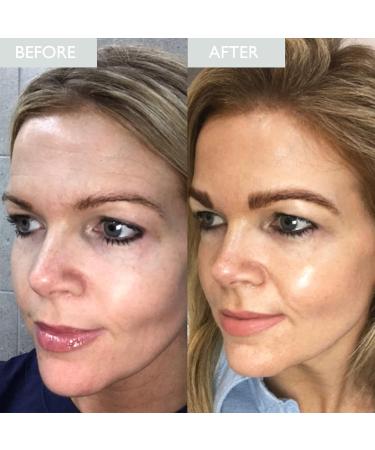 SKINICIAN Advanced Restoring Night Cream - Anti-Ageing Face Cream with Vitamin C - Regenacell Formula for Younger Looking Skin in 4 Weeks - Evening Skincare - Vegan & Cruelty Free (50ml) - Buy Online on GoSupps.com