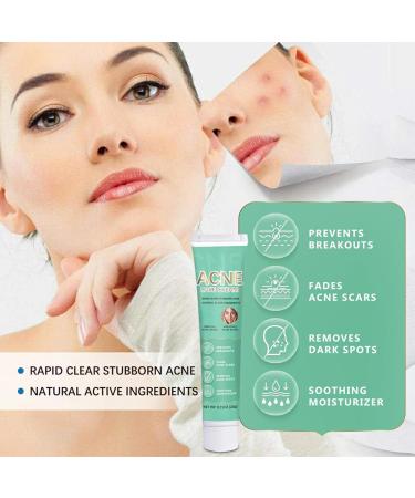 Acne Cream Anti Acne Face Cream for Acne Treatment and Spot Treatment Pimple Treatment Gel Cream For Face Blemishes & Blackheads Reduce Redness Moisturiser Fade acne marks Oil Control - Buy Online on GoSupps.com