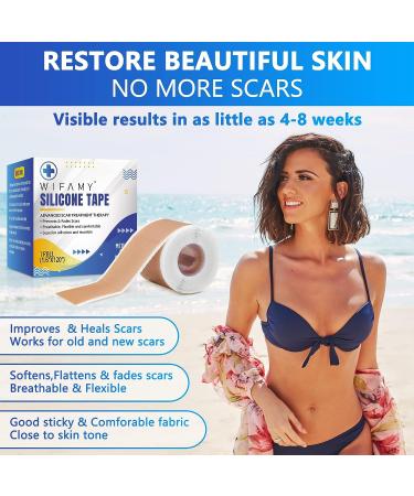 Silicone Scar Sheets & Tape 1.6x120 - Reusable Treatment for C-Section, Burn, Surgery & Acne Scars - Buy Online on GoSupps.com