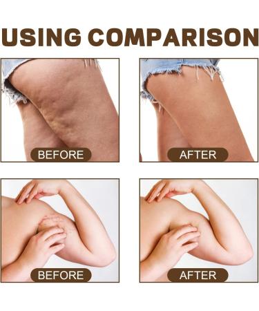 Advanced Collagen Body Sculpting Oil Advanced Collagen Body Lifting Oil Collagen Lifting Body Oil Suitable for Body Contour Enhancement All T - Buy Online on GoSupps.com