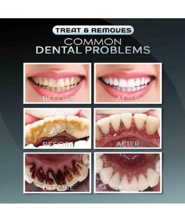 Bamboo Charcoal Deep Toothpaste | Teeth Whitening & Fresh Breath | Activated Carbon Toothpaste for Deep Stain Removal & Brightening - Weisse Zahn (1PC) - Buy Online on GoSupps.com