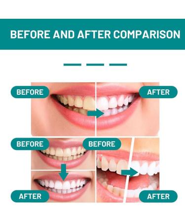 Furzero Smart Smile Mouthwash - Teeth Whitening & Deep Cleaning Dental Foam (2PCS) - Refreshing Breath & Total Care for Oral Health - Buy Online on GoSupps.com