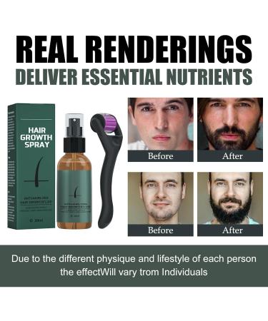 Beard Growth Kit for Men - Derma Roller & Serum for Rapid Growth and Thickening - Buy Online on GoSupps.com