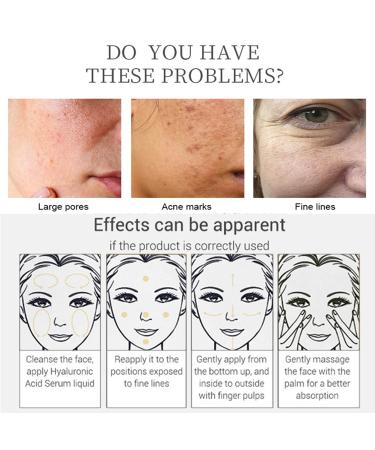 AICHUN BEAUTY Face Serum Eye Essence Anti-Wrinkle Anti-Acne Moisturizing & Pore Shrinking - 30ml Niacinamide 10% + Zinc 1% - International Shipping Available - Buy Online on GoSupps.com