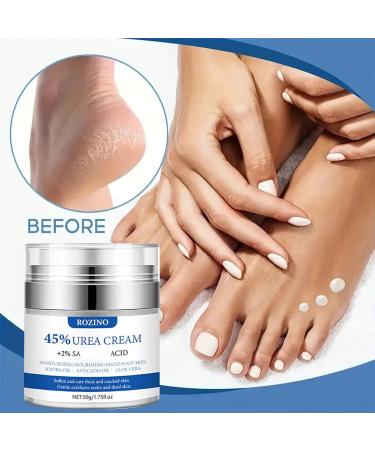 Urea Foot Cream - 45% Urea Cream for Feet - Cracked Heel Repair Cream - Foot Nourishing Cream for Dry Skin Deep Moisturizing - 50g Callus Remover Nourishes Soften for Feet and hand - Buy Online on GoSupps.com