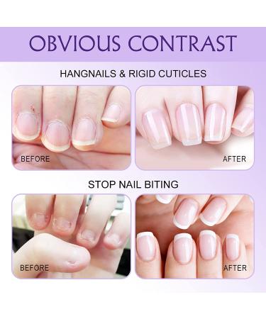 Nailive Jojoba Cuticle Oil with Lavender Extract & Vitamin E - 0.5oz | For Dry & Cracked Cuticles, Moisturizing & Soothing Formula - Buy Online on GoSupps.com