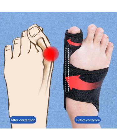 Grebest Toe Valgus Corrector - Soft & Durable Toe Correction Belt for Health Care - One Size - Buy Online on GoSupps.com