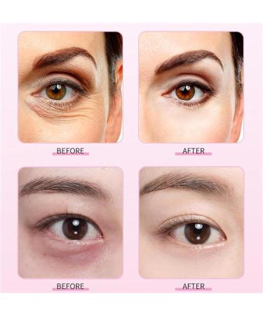 Mango Revitalize Eye Cream | 2PCS - Eliminate 99% Eye Bags & Dark Circles | Firming Skin Solution - Buy Online on GoSupps.com