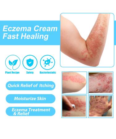 Eczema Relief Cream | Moisturizing Lotion for Eczema-Prone Skin | Full Body Moisturizer with 1% Hydrocortisone - Buy Online on GoSupps.com