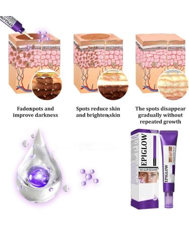 JIAOY EPIGLOW Advanced Pigmentation Cream Tone Correction Moisturizer EPIGLOW Pigmentation Treatment Cream AntiAging Face Removes Dark Spots Skin Buildup 6 Pack 6 Pack - Buy Online on GoSupps.com