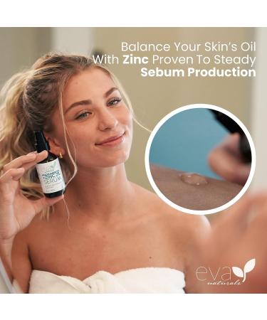 Niacinamide Serum for Face with Zinc, Hyaluronic Acid - Brighten, Minimize Pores, Reduce Oil, Fade Dark Spots - Anti-Aging Formula (2 oz) - Buy Online on GoSupps.com