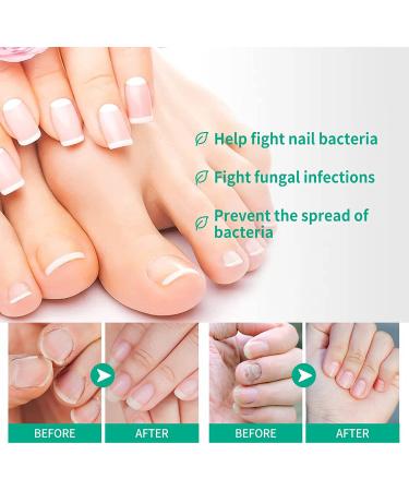 Kerassentials Toe Nails Lotion - Advanced Oil Formula with Applicator (3pc) | Reviews - Buy Online on GoSupps.com