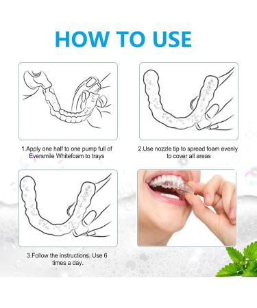 Retainer Cleaner Aligner Cleaner Clear Retainer Cleaner Teeth Aligner Foam Retainer Whitening Foam Retainer Cleaning Spray for Oral Appliances Dentures Retainers and Aligners Fights Bad Breath 60ml - Buy Online on GoSupps.com