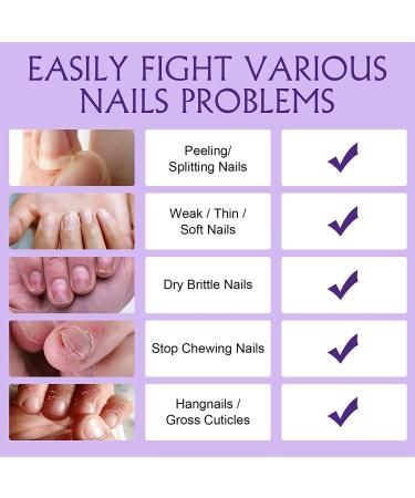 Nailive Jojoba Cuticle Oil with Lavender Extract & Vitamin E - 0.5oz | For Dry & Cracked Cuticles, Moisturizing & Soothing Formula - Buy Online on GoSupps.com