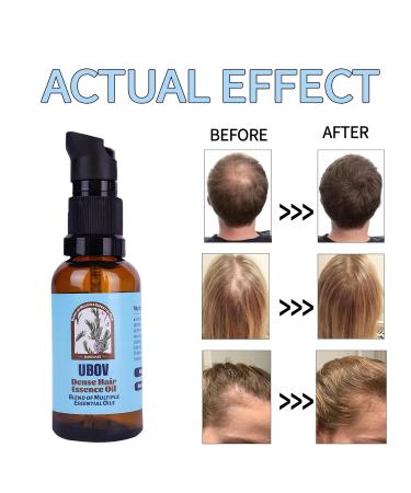 Organic Rosemary Oil for Hair Growth - Essential Hair Oil for Dry Scalp Volume & Shine (1oz 30ml) - International Shipping Available - Buy Online on GoSupps.com