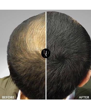  LDN Professional LDN Professional Hair Fibers No. 1. Hair fibers for hair loss and thinning hair instantly thicken hair naturally 22g bottle of hair fibers (medium brown) - Buy Online on GoSupps.com