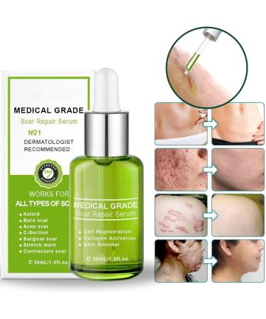 Goopgen Advanced Scar Repair Serum - Nature Scar Treatment for Acne, Surgical Scars, and Stretch Marks (1pcs) - Buy Online on GoSupps.com