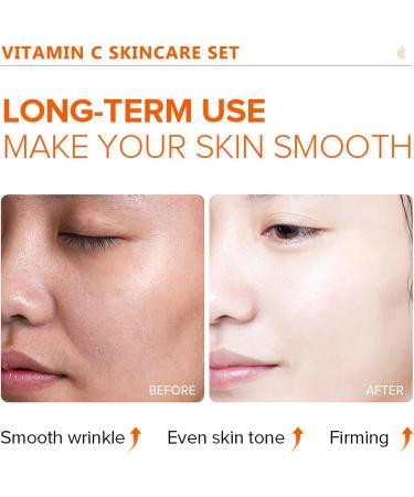 Vitamin C Skincare Set- Gifts For Teenage Girls & Women Vegan Beauty Gifs Gift For Her Birthday Gift Includes Face Serum Eye Cream-Cleanser Toner Moisturiser Set For Anti-Aging-Improve Acne marks - Buy Online on GoSupps.com