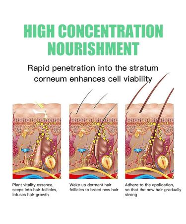 Shenrongtong Rosemary Oil for Hair Growth - Pure Essential 2.11 fl oz Bio-Rosmarin Oil Nourishes Scalp & Stimulates Hair Growth - Buy Online on GoSupps.com