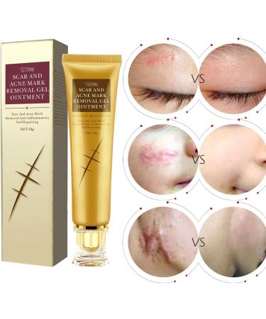 Scar Repairing Gel with Easy-to-Use Soft Texture Plant Extract Ingredients for Refreshing Skin - Reduces Scars & Spots - 30g/1.1oz - Buy Online on GoSupps.com