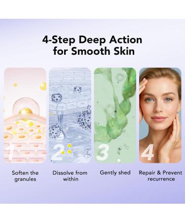 DERMFREE MILIA REMOVER 30 mL Milia Remover Treatment Milia Spot Treatment with Salicylic Acid Milia Acne Serum Clearing Skin Essence - Buy Online on GoSupps.com