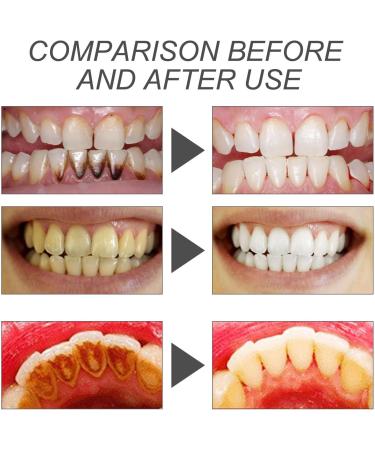 Natural Bamboo Activated Carbon Powder - Teeth Whitening & Cleaning | Charcoal Tooth Whitening Powder - 1 Piece - Buy Online on GoSupps.com