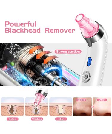 Blackhead Remover Pore Vacuum Facial Pore Cleaner Electric Acne Comedone Whitehead Extractor Tool with 5 Suction Power 4 Probes Blackhead Remover Suction for Women & Men (Pink) - Buy Online on GoSupps.com
