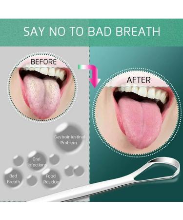 Buy High-Quality Stainless Steel Dental Floss & Tongue Scraper Set - 3 Pieces for Sensitive Tongues | Effective Oral Care Tools - Buy Online on GoSupps.com