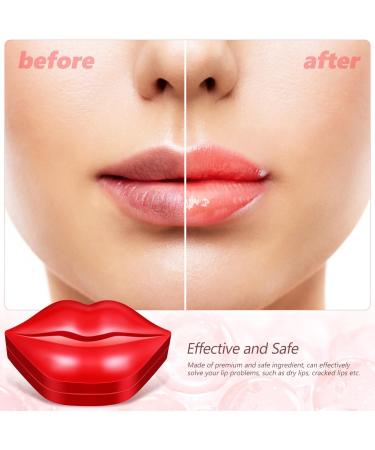minkissy Sleeping Lip Gel Pads Lip Mask For Dry Lips Moisturizing Lip Mask Lip Care Product - Buy Online on GoSupps.com