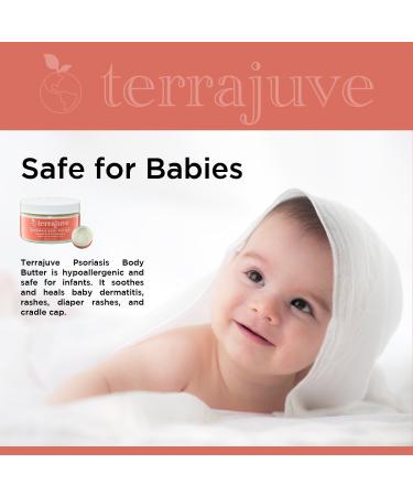 Terrajuve Psoriasis Treatment Cream: Natural Soothing Lotion for Dry, Itchy Skin - Organic, Safe for Baby - Made in USA - Buy Online on GoSupps.com