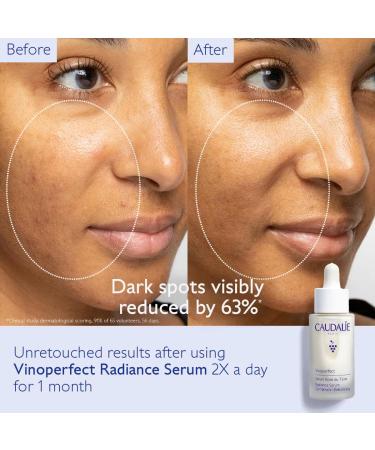 Caudalie Vinoperfect Radiance Serum - Buy Online on GoSupps.com