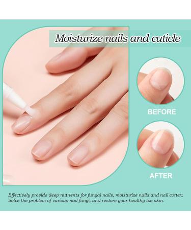 4-Piece Nail Care Pen Set | Nail Repair with Tea Tree Oil Vitamin E & Aloe Vera | Perfect for Healthy Fingernails & Toenails - Buy Online on GoSupps.com
