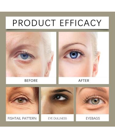 Retinol Firming Eye Cream Creme Anti Cerne Eye Contour Cream Effectively Nourishes Eye Skin Instant Iift Plus Cernes Under Eye Bags And Wrinkles Instant Eye Lift Removes Bags Dark Circles - Buy Online on GoSupps.com