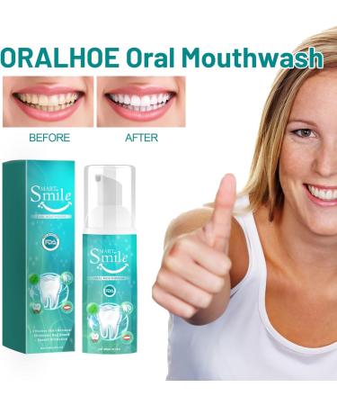 Furzero Smatsmile Mouthwash - Teeth Whitening & Total Oral Care | Deep Cleaning Dental Foam for Refreshing Breath (1PC) - Shop Internationally - Buy Online on GoSupps.com