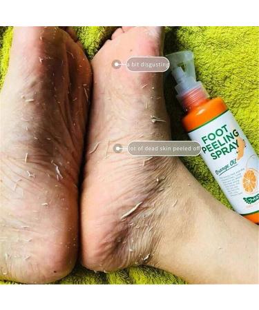 Foot Peeling Spray with Orange Oil Exfoliate Dead Skin & Calluses Fast | Hydrating & Nourishing Formula - Buy Online on GoSupps.com