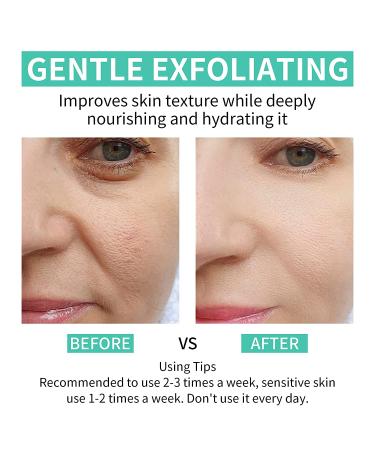 Glycolic Acid 35% Peel Pads with Vitamins B5, C & E - Anti-Aging Formula for Dark Spots, Acne, Fine Lines & Wrinkles - 50 Pads - Buy Online on GoSupps.com