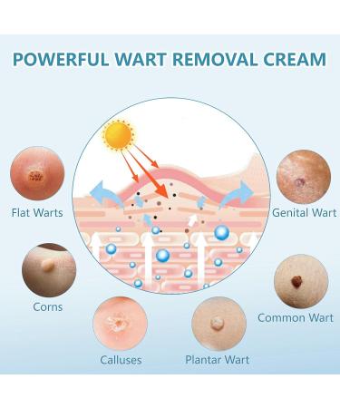 Wart Remover Fast Acting Gel - Freeze Off Ointment & Cream for Genital Plantar Common Warts - 2 Pack - Buy Online on GoSupps.com