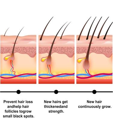 Batana Oil for Hair Growth Batana Oil Organic for Healthy Hair Deeply Nourishing Scalp Roll-On Hair Growth Essence Nourishes Thin Hair Scalp Skin and Loss Hair Growth Fir for All Hair Types - Buy Online on GoSupps.com