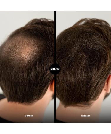 SHAKE OVER Kit de cheveux v g taliens pour paissir les cheveux fibres enrichies en zinc cheveux de qualit sup rieure fabriqu s en Europe (recharge de 12 g et 30 g marron clair applicateur de 5_LIGHT BROWN - Buy Online on GoSupps.com
