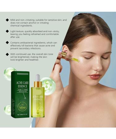 Acne Treatment Serum - Hydrating Oil-Control Formula Fades Acne Marks Brightens & Smoothes Skin Gentle Facial Care(2PCS) - Buy Online on GoSupps.com