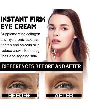  Hengxuan Eelhoe Instant Firming Eye Cream Anti-aging eye contour cream for under-eye bags anti-dark circles and under-eye puffiness firming serum reduces fine lines for women 60 ml (1) - Buy Online on GoSupps.com
